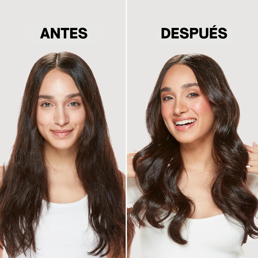 CO Roller 31pk Assorted Sized Self Grip Rollers